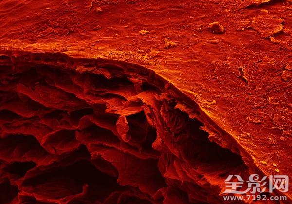 显微摄影术 显微摄影照片