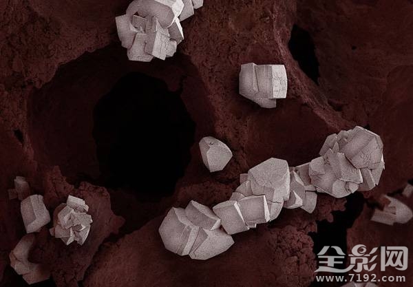 显微摄影术 显微摄影照片