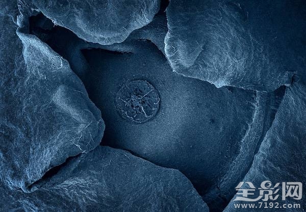 显微摄影术 显微摄影照片